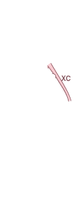 A필러(좌)