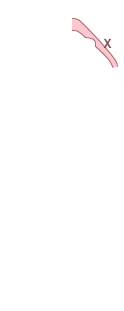 A필러(좌)