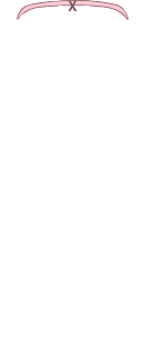 앞범퍼
