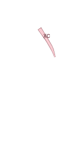 A필러(좌)