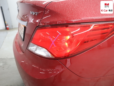 2017 - hyundai accent