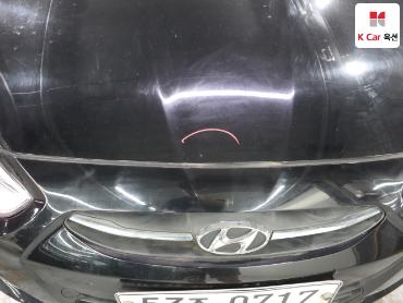 2017 - hyundai accent